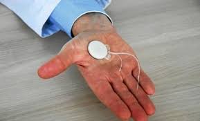 Appareil Auditif: Pose d'un Implant Cocléaire assistée par un robot