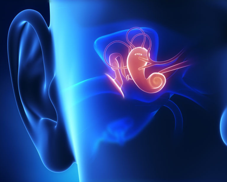 Les mécanisme de la perte d'audition - L'oreille